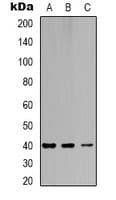NR1I3 / CAR Antibody (Internal)