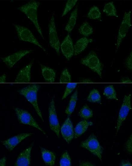 BABP / AKR1C2 Antibody