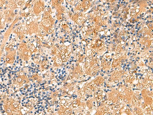 RPL13A Antibody