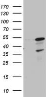 Monoclonal Mouse anti-Human CDCA7L Antibody (clone OTI1A12, aa1-337, IHC, WB)