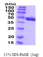Human CCBL1 Protein (Recombinant His)