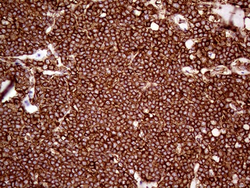 IQGAP1 Antibody (aa464-609, clone OTI6E1)