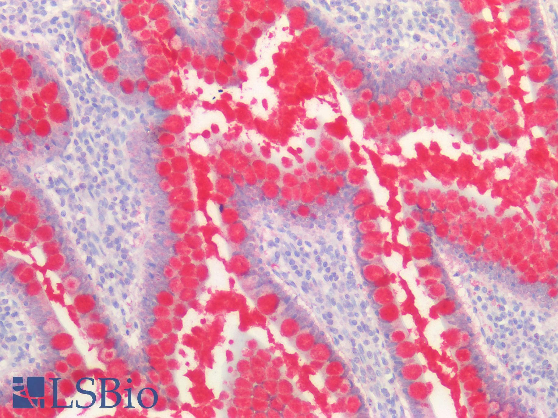 IHC-plus™ BMP2 Antibody