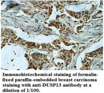Polyclonal Rabbit anti-Human DUSP13 Antibody (aa2-197, IHC, WB)