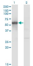 FLI1 Antibody (clone 1G8)