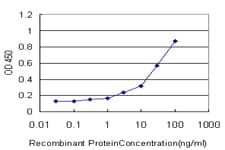 IHC-plus™ Monoclonal Mouse anti-Human PSMA7 Antibody (clone 1A10-3G12, IHC, IF, WB)