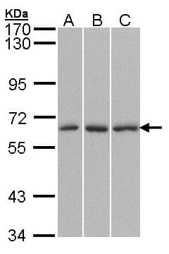 Polyclonal Rabbit anti-Human QIP1 / KPNA4 Antibody (aa459-521, IHC, WB)
