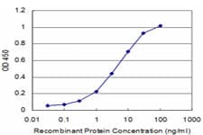 PRL / Prolactin Antibody (clone 1E1)