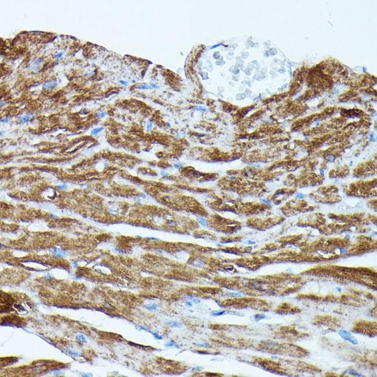PDE3A Antibody