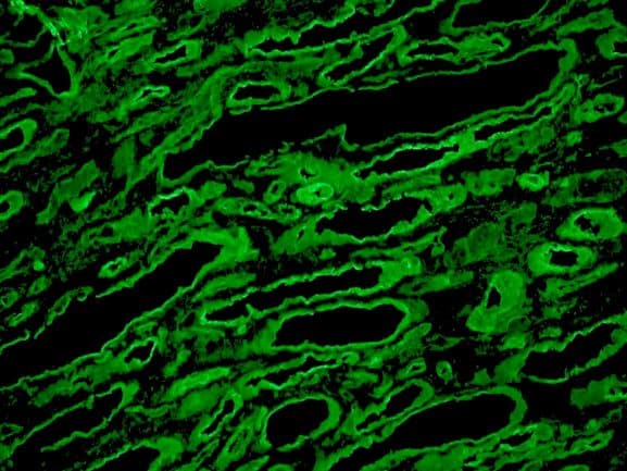 LAMC1 / Laminin Gamma 1 Antibody (clone A5)