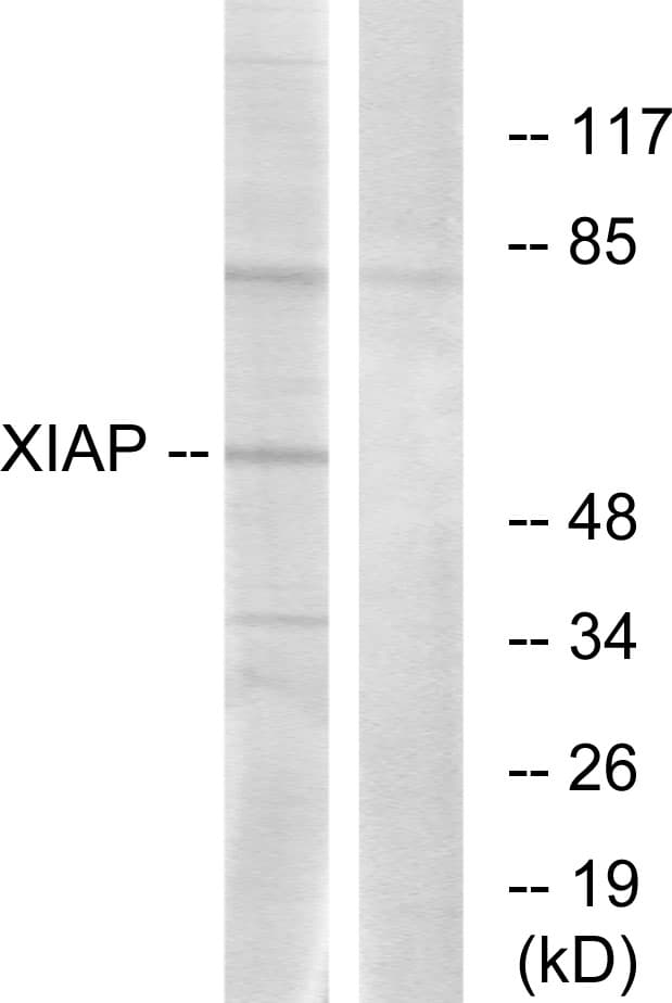Polyclonal Rabbit anti-Human XIAP Antibody (aa53-102, IHC, WB)