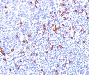 Mouse Anti-Human Kappa Light Chain Secondary Antibody (clone L1C1, Ready-to-Use)