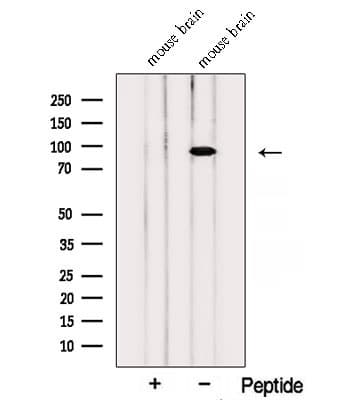 Polyclonal Rabbit anti-Human PTPRS Antibody (WB)