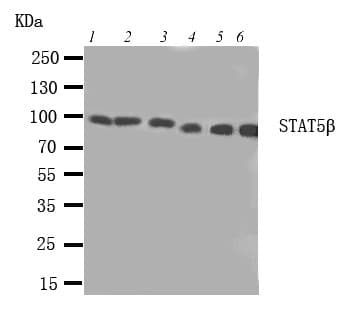 Polyclonal Rabbit anti-Human STAT5B Antibody (aa767-787, IHC, WB)
