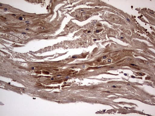 DOCK8 Antibody (aa832-1160, clone OTI4H10)