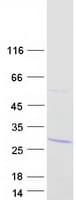 Human ZNF200 Protein (Recombinant Myc-DDK (Flag))