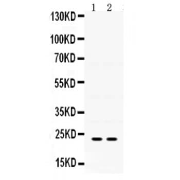IGFBP5 Antibody (aa76-114)