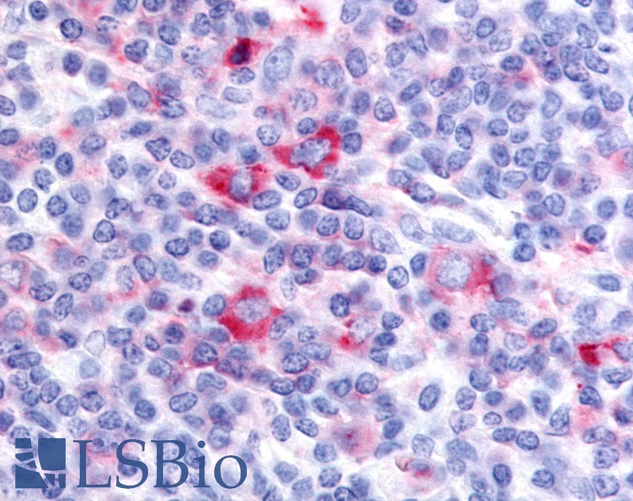 IHC-plus™ GPRC5D Antibody (Cytoplasmic Domain)