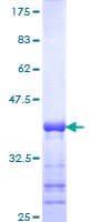 Human CABIN1 Protein (Recombinant GST, N-terminus)