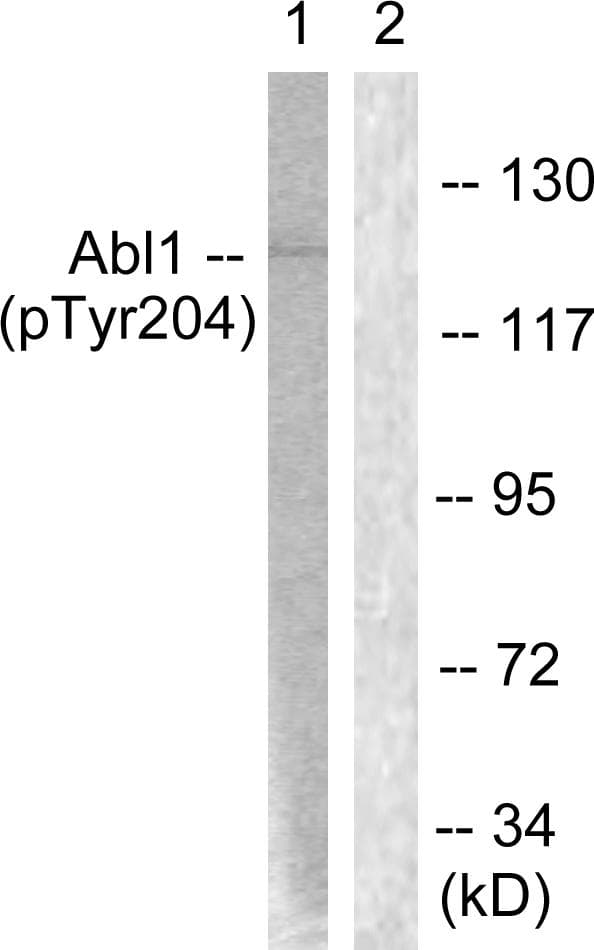 Polyclonal Rabbit anti-Human ABL1 / c-ABL Antibody (phospho-Tyr204, WB)