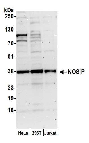 NOSIP Antibody (aa100-150)
