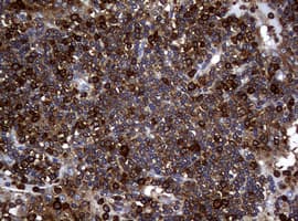 NME1 / NM23 Antibody (clone OTI22F10)