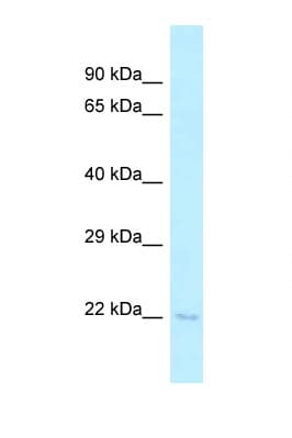 Polyclonal Rabbit anti-Mouse TSEN15 Antibody (C-Terminus, WB)