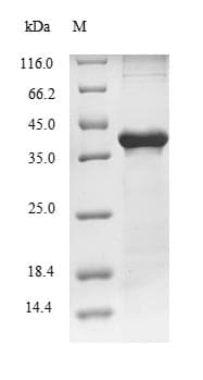 Rat CPA1 / Carboxypeptidase A Protein (Recombinant 10His, N-terminus + Myc, C-terminus)
