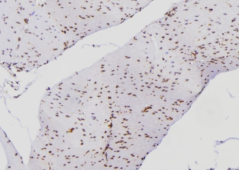 XRCC6 / Ku70 Antibody