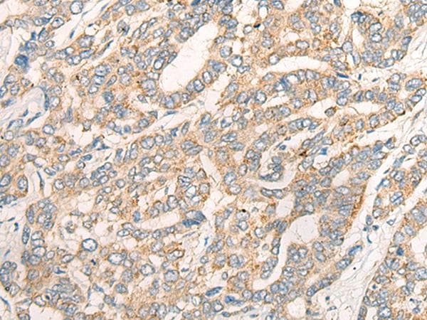 Polyclonal Rabbit anti-Human CCL16 / LEC Antibody (IHC)