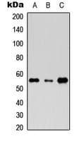 RTKN / Rhotekin Antibody (Internal)
