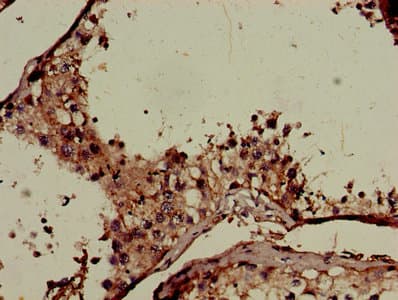 CNKSR2 Antibody (aa650-800)