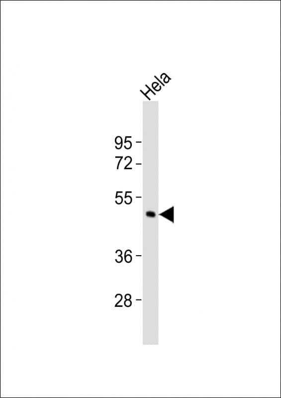 CHST4 / GlcNAc6ST2 Antibody (aa357-390)