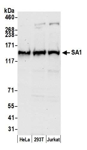 STAG1 / SA1 Antibody (aa1150-1200)