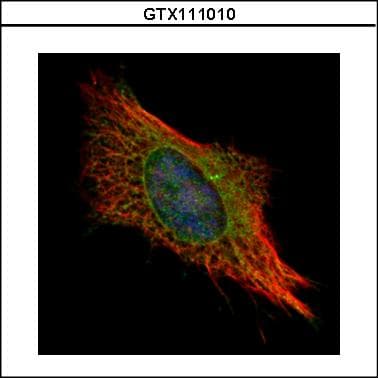 Polyclonal Rabbit anti-Human FIS1 Antibody (aa1-152, IHC, WB)