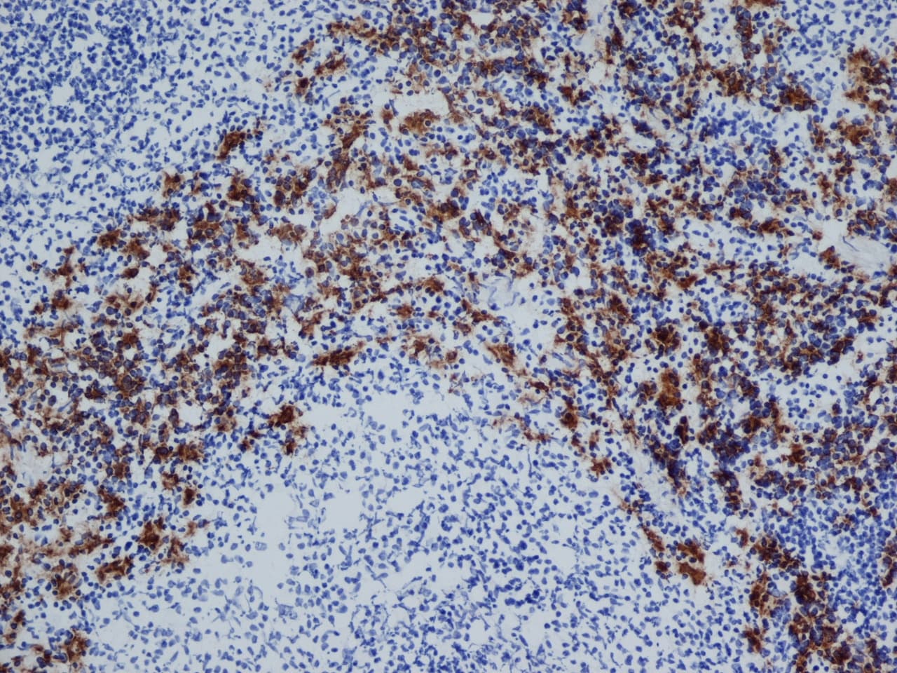 CD163 Antibody (clone ED2)
