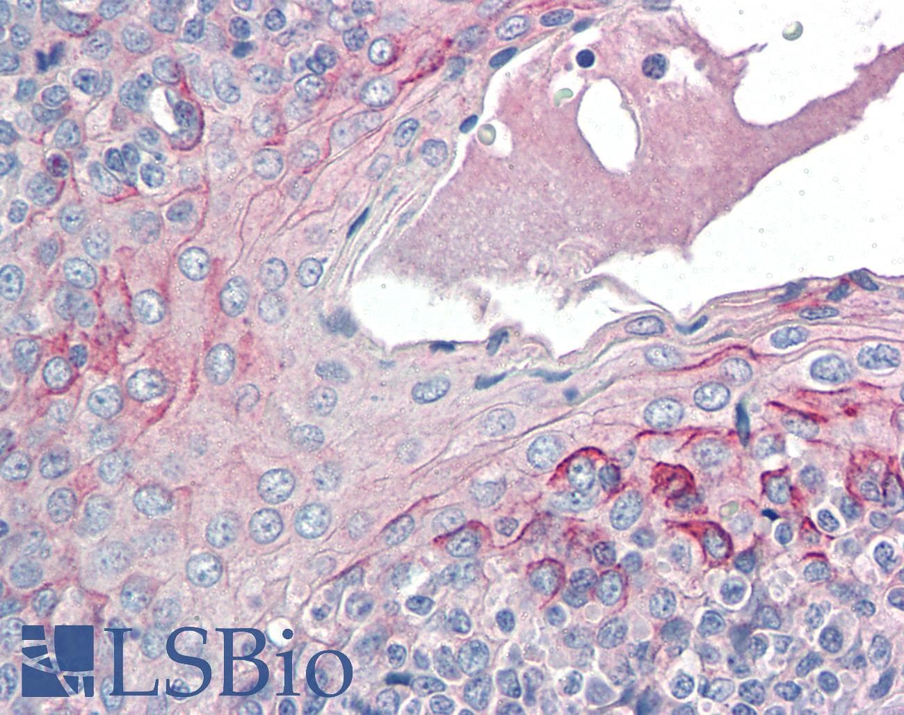 IHC-plus™ Polyclonal Goat anti-Human CCR6 Antibody (aa18-46, IHC)