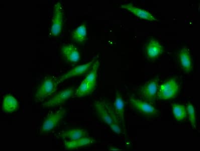 Polyclonal Rabbit anti-Human NSDHL Antibody (IHC, IF, WB)