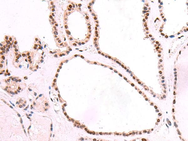 SF3B130 / SF3B3 Antibody