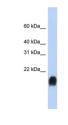 EMA / MUC1 Antibody (Internal)