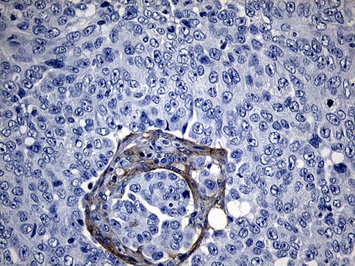 Monoclonal Mouse anti-Human ROR2 Antibody (clone OTI4B10, aa796-927, IHC, WB)