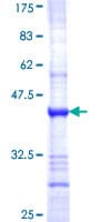 Human ASB4 Protein (Recombinant GST, N-terminus)