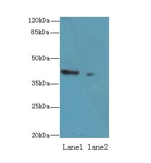 Polyclonal Rabbit anti-Human ALS2CR1 / NIF3L1 Antibody (IHC, WB)