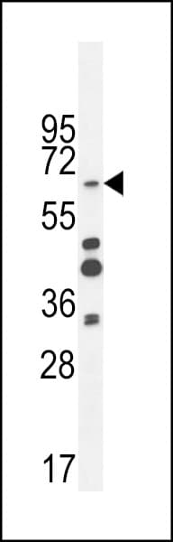 ZNF98 Antibody (aa520-549)