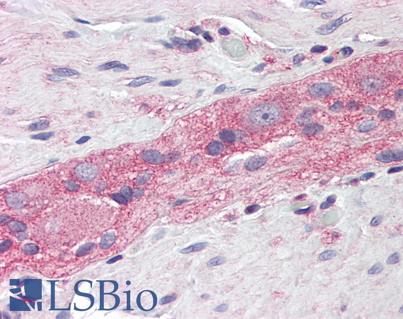 IHC-plus™ RHOA Antibody (clone 1C1)