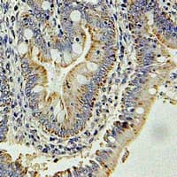 GLNRS / QARS Antibody