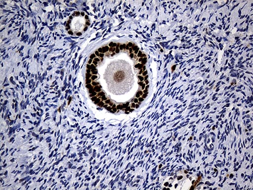 ALOX5 / 5-LOX Antibody (aa18-364, clone OTI1C1)