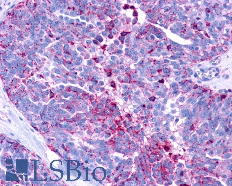 PathPlus™ Polyclonal Rabbit anti-Human LPAR3 / LPA3 / EDG7 Antibody (Cytoplasmic Domain, IHC)