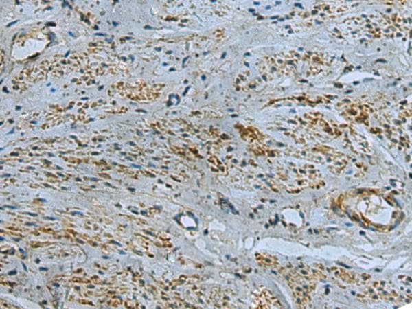 IL17RD Antibody