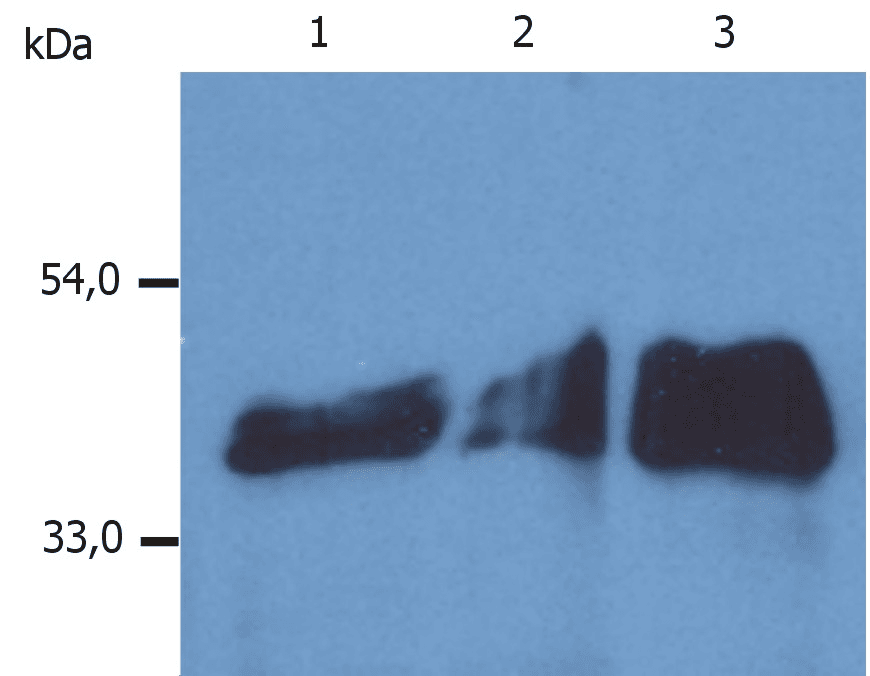 PathPlus™ KRT18 / CK18 / Cytokeratin 18 Antibody (clone DA-7)